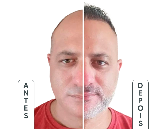 Antes e depois da Hair